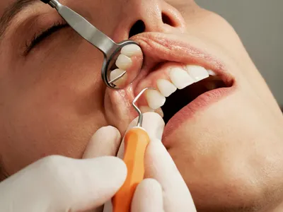 Periodoncia y salud de encías Clínica Carabanchel